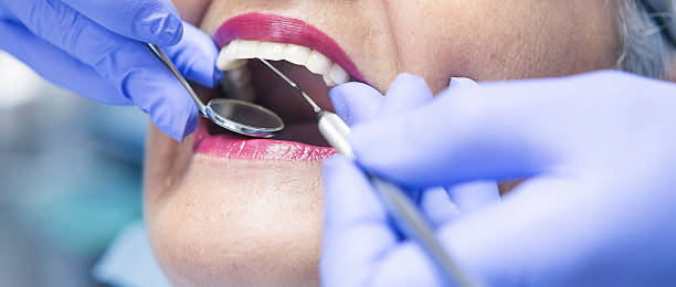 Best Urgent Care for Lost Fillings or Crowns in Mineral Ridge, OH