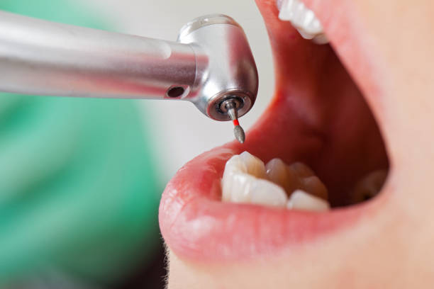 Best Pediatric Emergency Dentist in Mineral Ridge, OH
